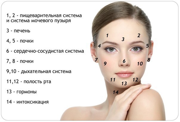 Акне на Лице